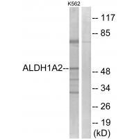 ALDH1A2 Antibody[34986]