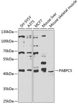 PABPC5 Rabbit Polyclonal Antib