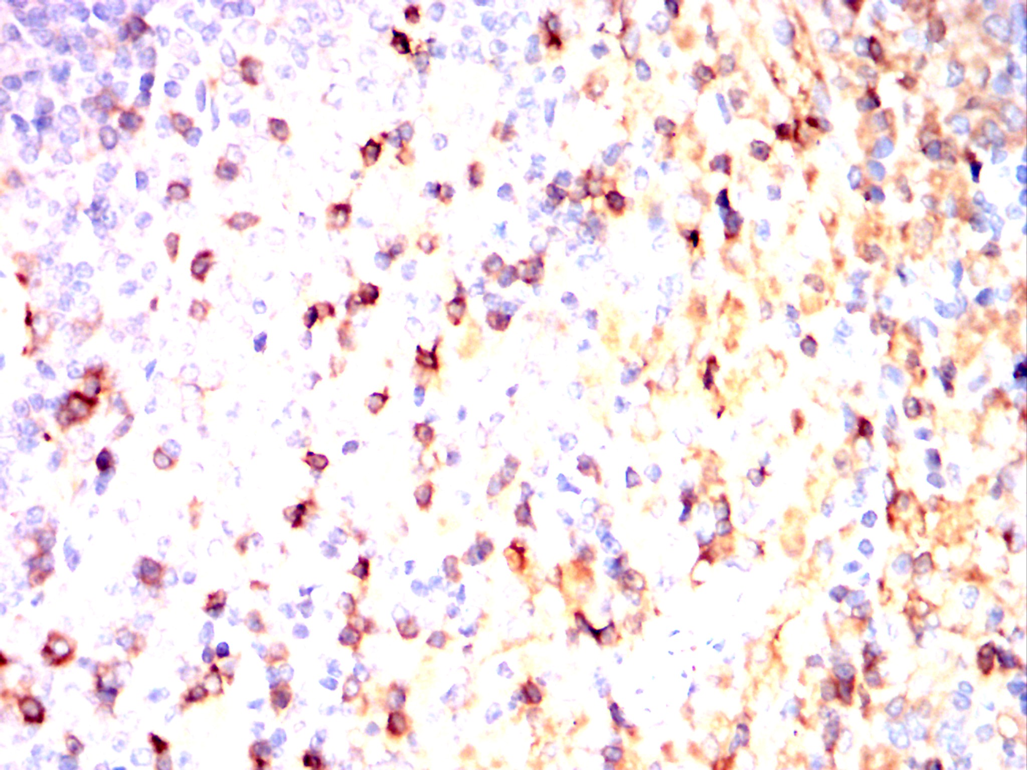 THY1 Mouse mAb[64315]