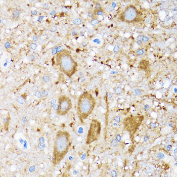 HSPH1 antibody[39052]