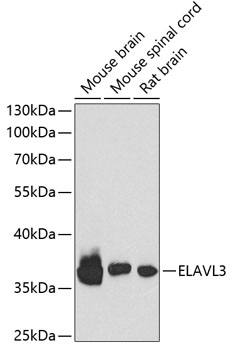 ELAVL3 Rabbit Polyclonal Antib