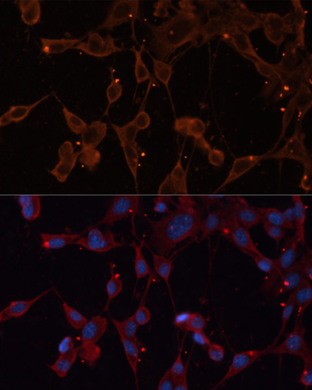INPP5B Rabbit Polyclonal Antib