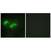 TFAM Antibody[33841]