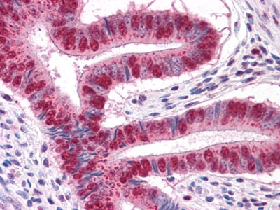 MUM1 Mouse mAb[63971]