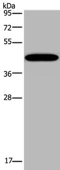 KCNK13 Antibody[36567]