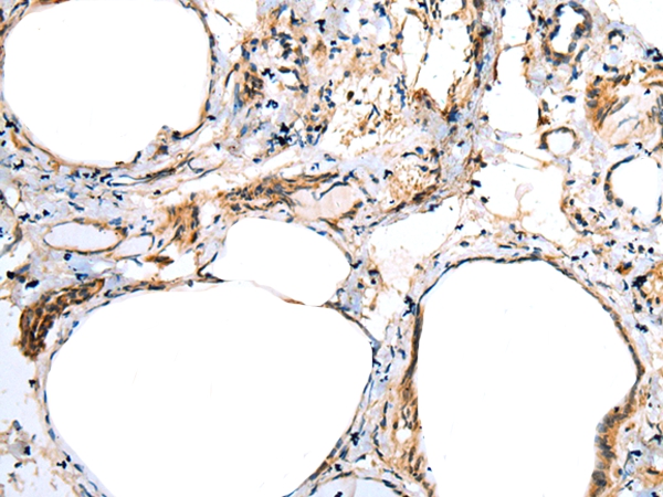 FSD1L Antibody[43362]