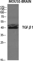 TGFβ1 Polyclonal Antibody[4149