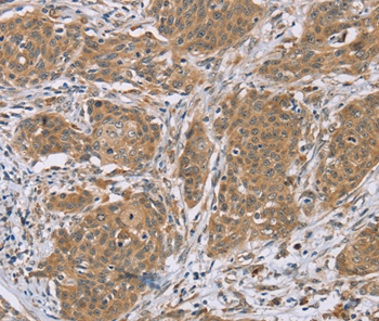 RNF139 Antibody[37873]