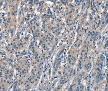 ACPT Antibody[37143]