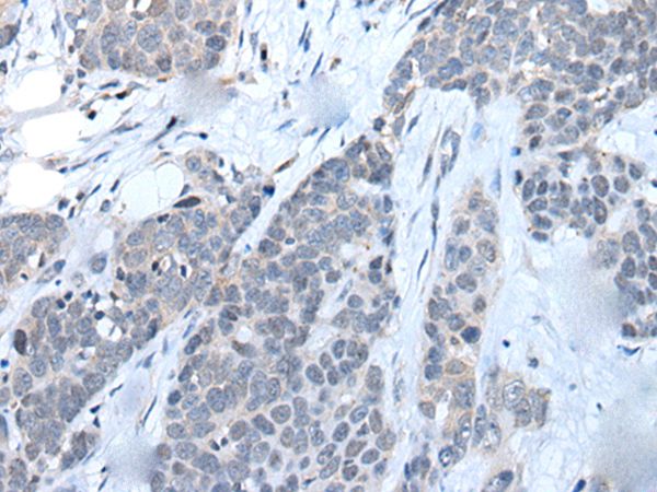 LILRB5 Antibody[43739]