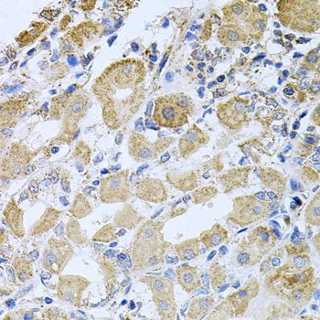 BCR Rabbit Polyclonal Antibody