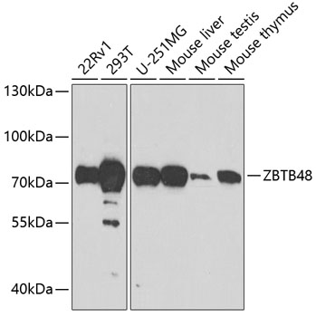 ZBTB48 Rabbit Polyclonal Antib