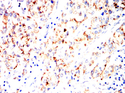 TYRO3 Mouse mAb[64377]