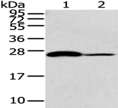 CD79A Antibody[43185]
