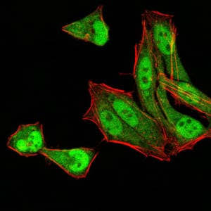 MGMT Mouse mAb[63931]