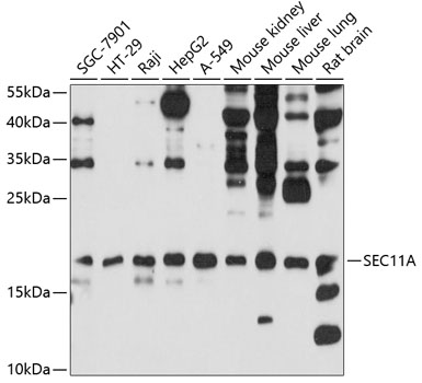 SEC11A Rabbit Polyclonal Antib