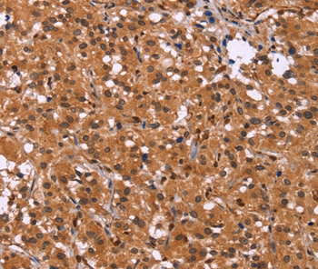 HDLBP Antibody[37615]