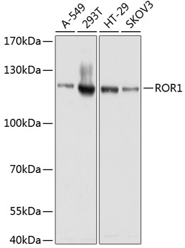 ROR1 Rabbit Polyclonal Antibod