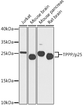 TPPP Rabbit Polyclonal Antibod
