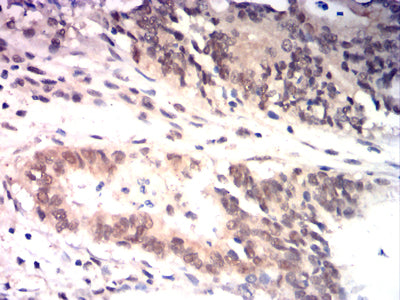 HSP70 Mouse mAb[63751]