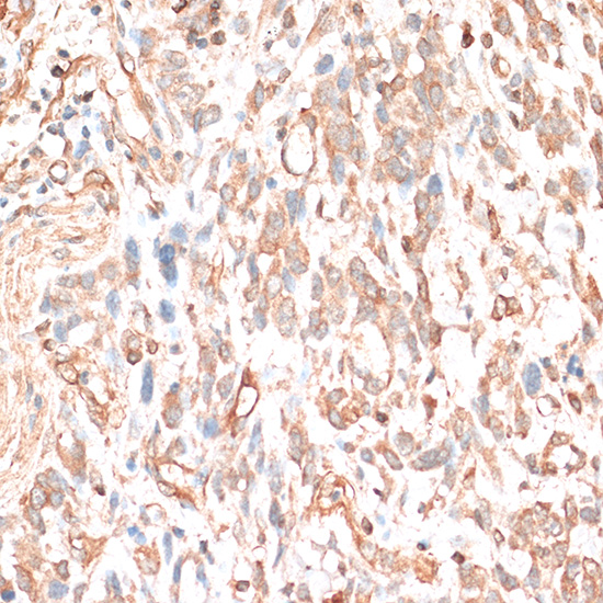 CDH11 Rabbit Polyclonal Antibo