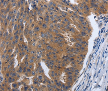 PDGFA Antibody[37213]