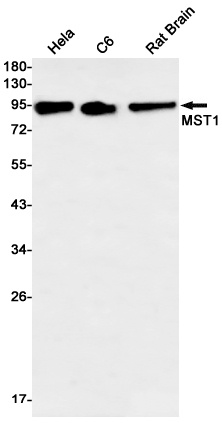 MST1 Rabbit mAb[52672]