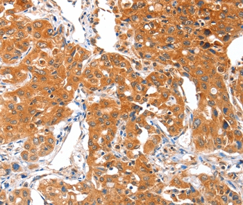 ACSBG1 Antibody[36024]
