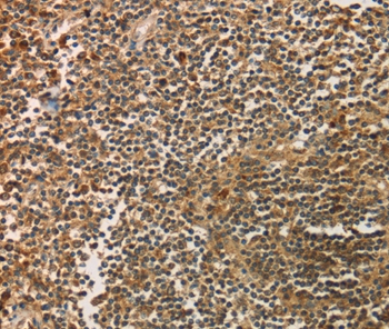 SIGLEC15 Antibody[37925]