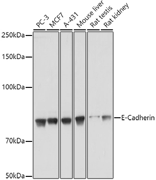 E-Cadherin Rabbit Polyclonal A