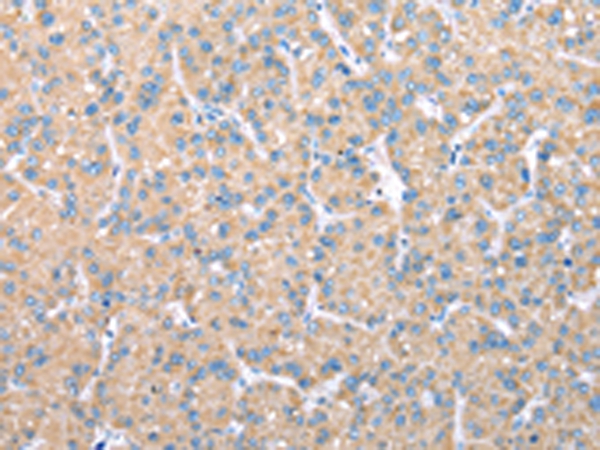 VAPA Antibody[42826]