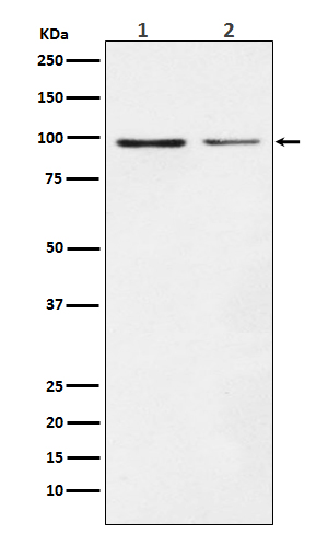 Dynamin 1 Rabbit mAb[56249]