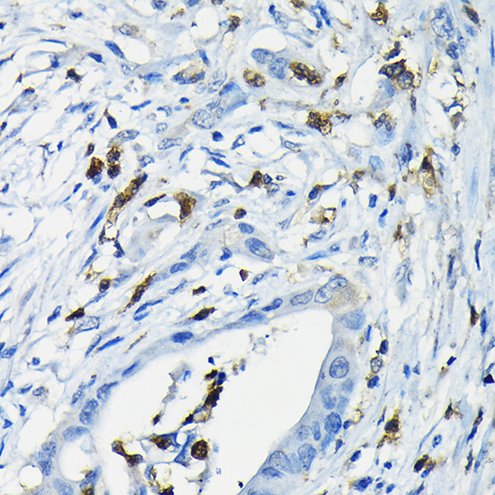 NFATC3 antibody[39086]