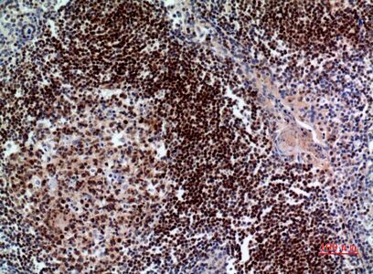 Pax-5 Polyclonal Antibody[4171