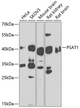 PSAT1 Rabbit Polyclonal Antibo