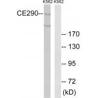 CEP290 Antibody[34563]