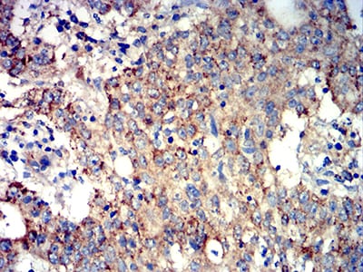 ATG3 Mouse mAb[63106]