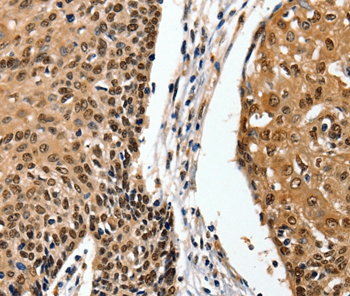 ITGAM Antibody[36962]