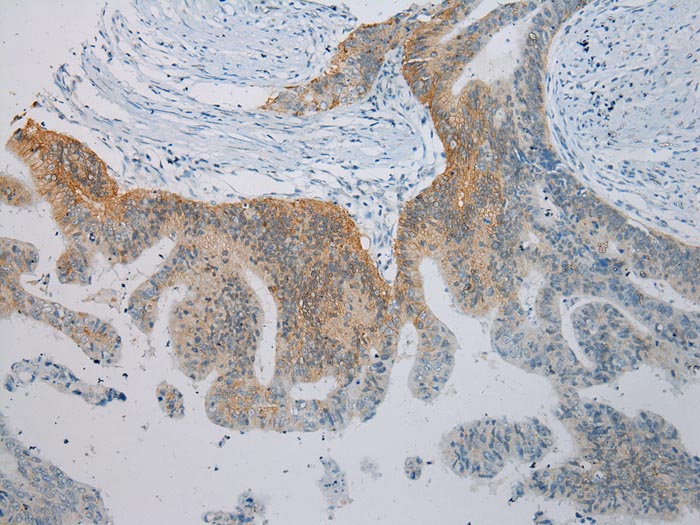 TLK2 Antibody[43337]