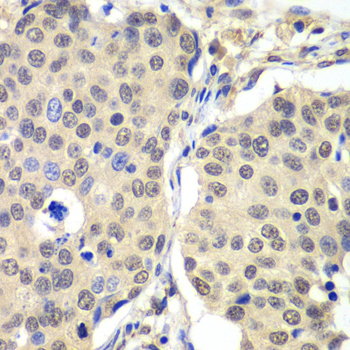 CCNC antibody[38997]