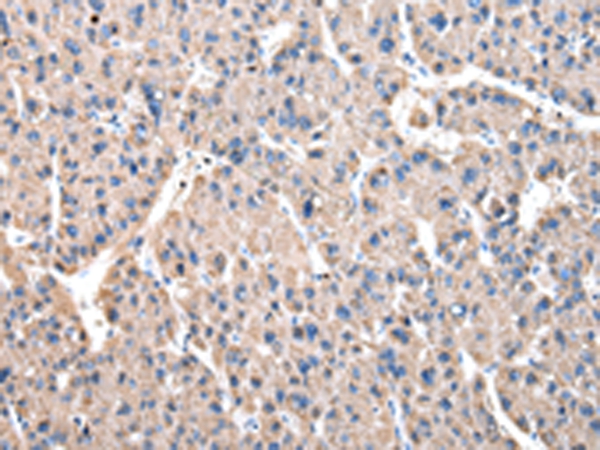 DARS Antibody[43072]