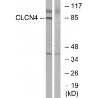 CLCN4 Antibody[34579]