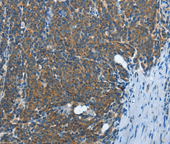 IL13RA2 Antibody[35601]