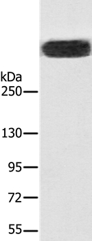 RYR1 Antibody[37887]