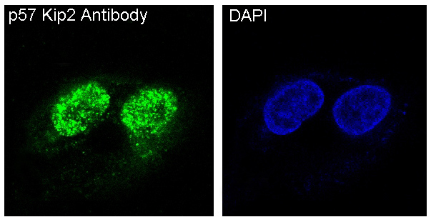 p57 Kip2 Rabbit mAb[56039]