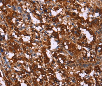 GAGE7 Antibody[37585]
