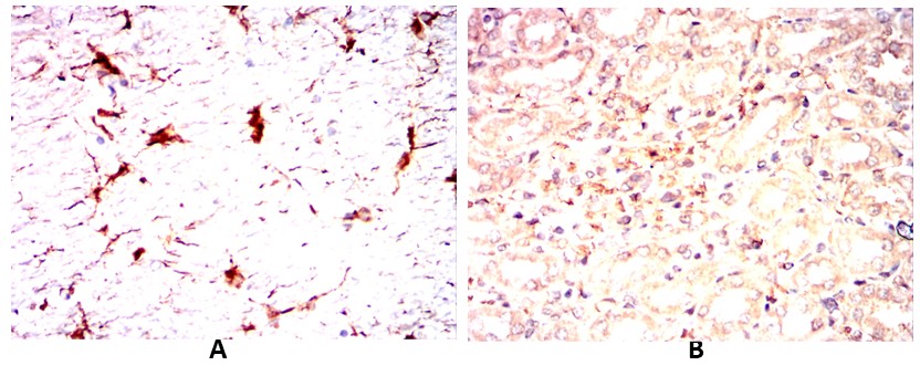 TNFSF11 Mouse mAb[64341]
