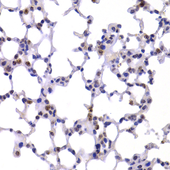 CBX5 Rabbit Polyclonal Antibod
