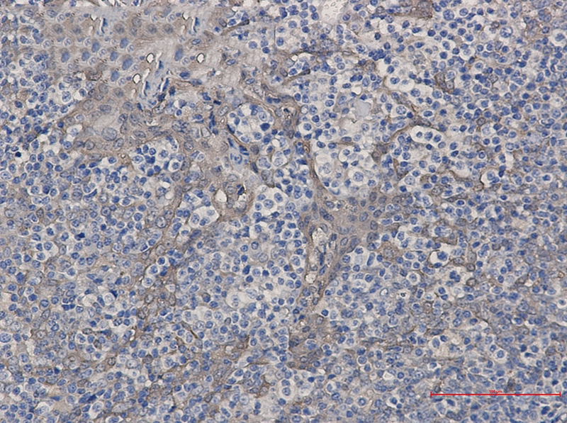 Cystatin B Rabbit mAb[52747]
