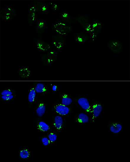 GM130 Rabbit Polyclonal Antibo